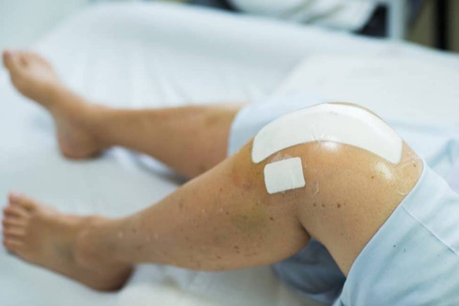 Best Knee Replacement Surgery in Baner