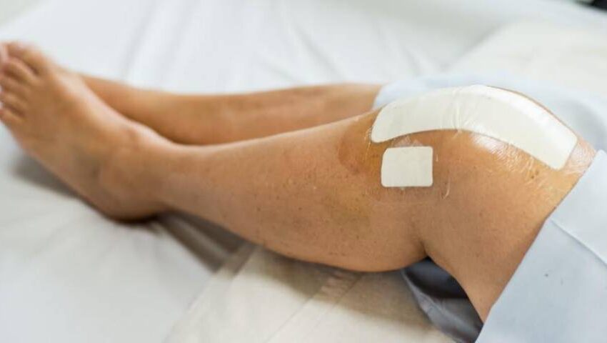signs that you need knee replacement surgery